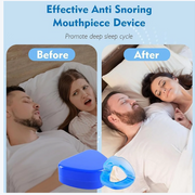 Anti Snore Mouthpiece – Stop Snoring & Sleep Better thumbnail